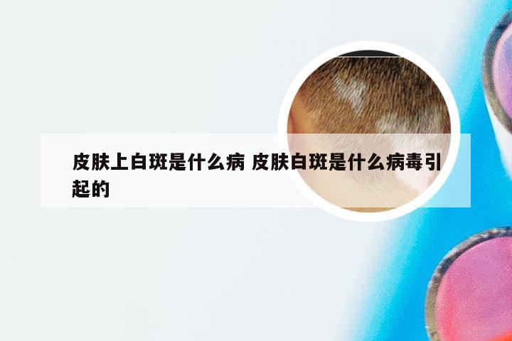 皮肤上白斑是什么病 皮肤白斑是什么病毒引起的