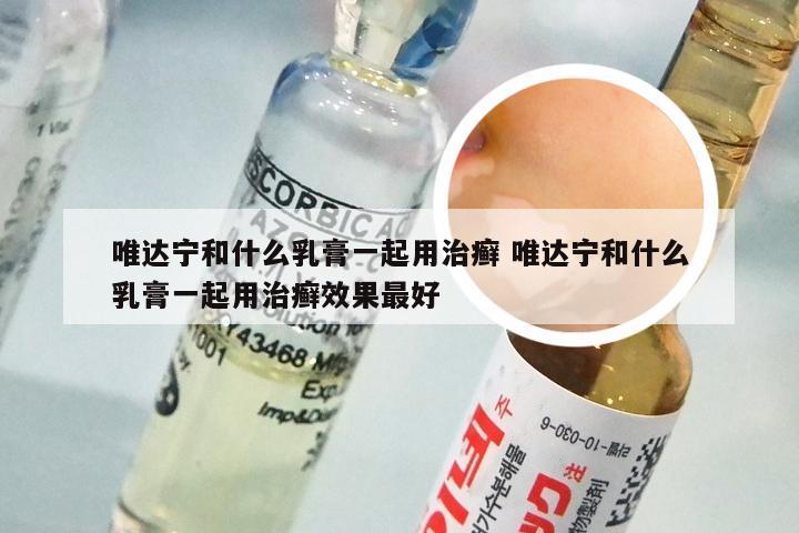 唯达宁和什么乳膏一起用治癣 唯达宁和什么乳膏一起用治癣效果最好