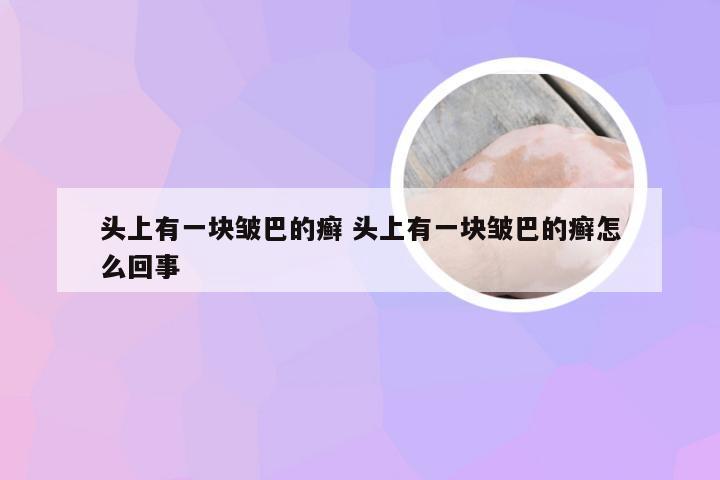 头上有一块皱巴的癣 头上有一块皱巴的癣怎么回事