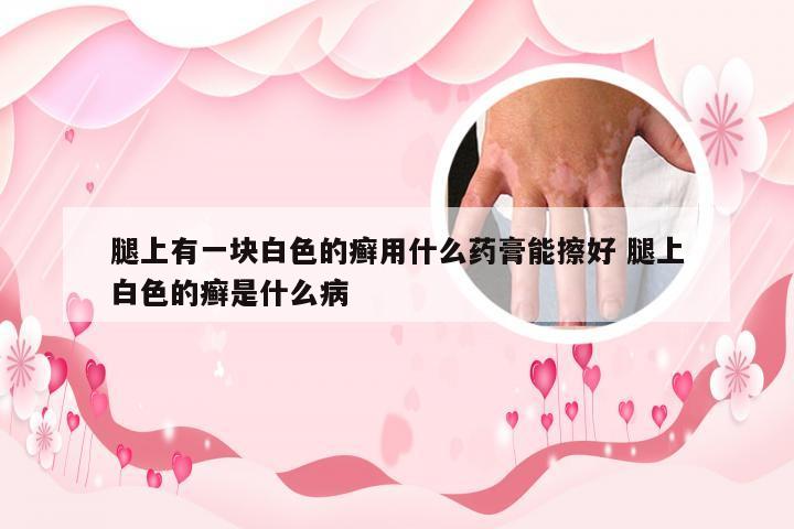 腿上有一块白色的癣用什么药膏能擦好 腿上白色的癣是什么病