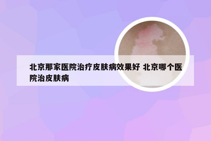 北京那家医院治疗皮肤病效果好 北京哪个医院治皮肤病