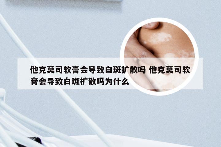 他克莫司软膏会导致白斑扩散吗 他克莫司软膏会导致白斑扩散吗为什么