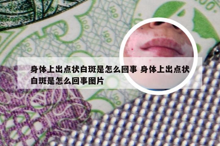 身体上出点状白斑是怎么回事 身体上出点状白斑是怎么回事图片