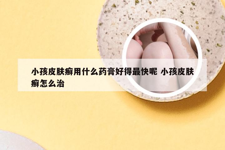 小孩皮肤癣用什么药膏好得最快呢 小孩皮肤癣怎么治