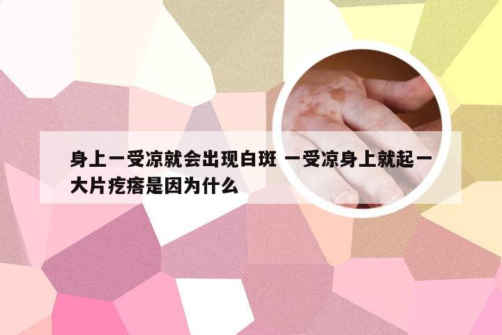 身上一受凉就会出现白斑 一受凉身上就起一大片疙瘩是因为什么