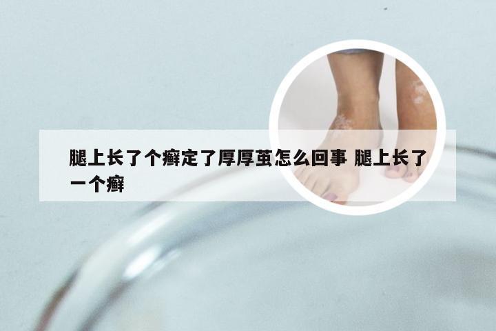 腿上长了个癣定了厚厚茧怎么回事 腿上长了一个癣