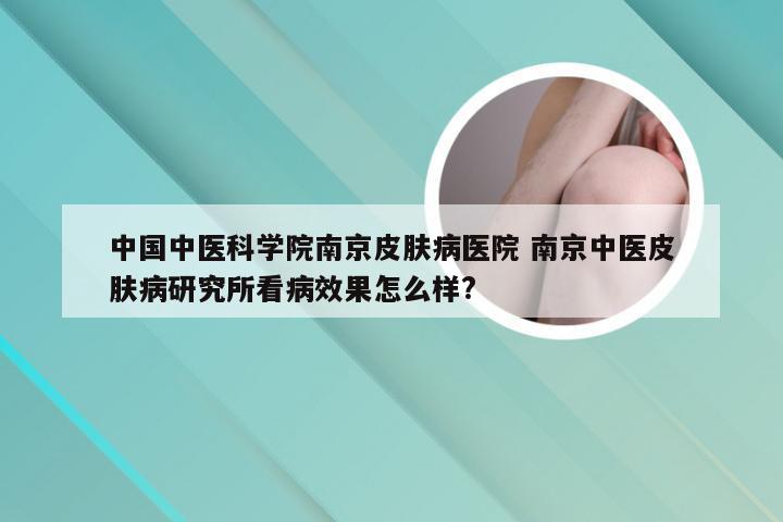 中国中医科学院南京皮肤病医院 南京中医皮肤病研究所看病效果怎么样?