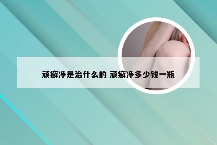 顽癣净是治什么的 顽癣净多少钱一瓶