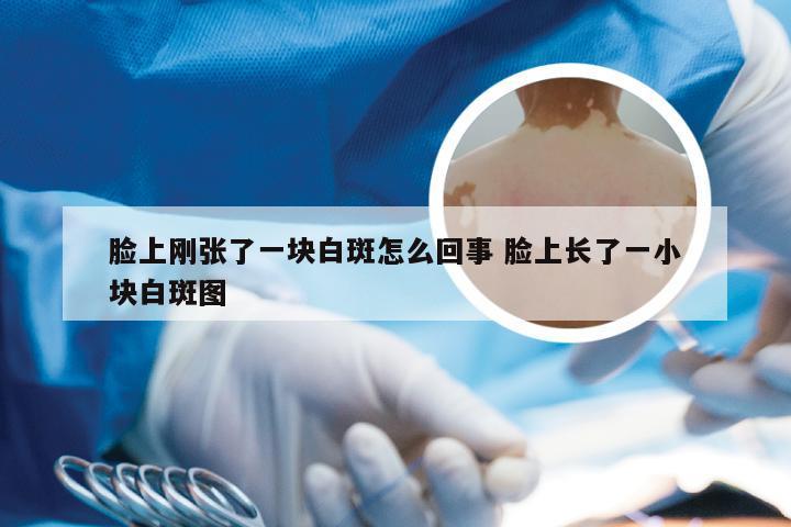 脸上刚张了一块白斑怎么回事 脸上长了一小块白斑图