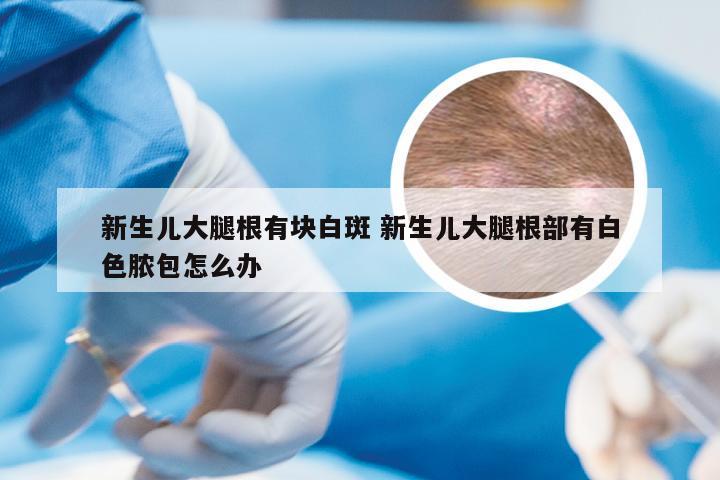 新生儿大腿根有块白斑 新生儿大腿根部有白色脓包怎么办