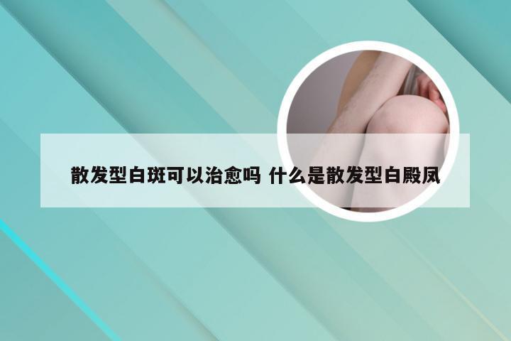 散发型白斑可以治愈吗 什么是散发型白殿凤