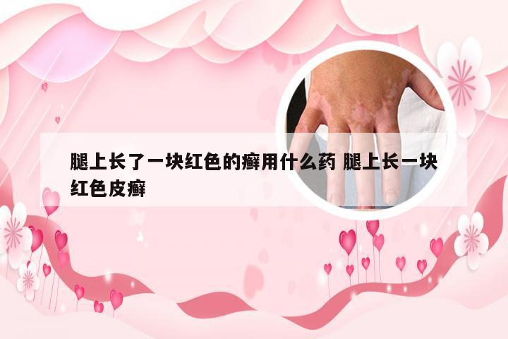 腿上长了一块红色的癣用什么药 腿上长一块红色皮癣