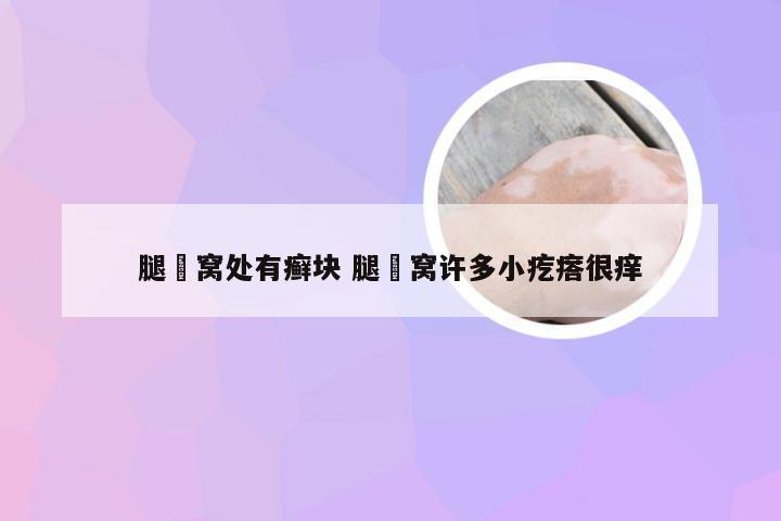 腿腘窝处有癣块 腿腘窝许多小疙瘩很痒