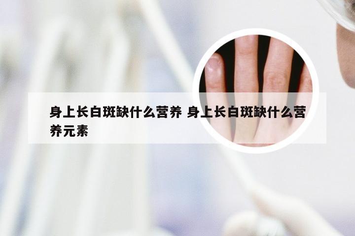 身上长白斑缺什么营养 身上长白斑缺什么营养元素