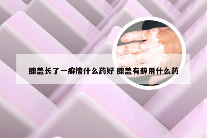 膝盖长了一癣擦什么药好 膝盖有藓用什么药