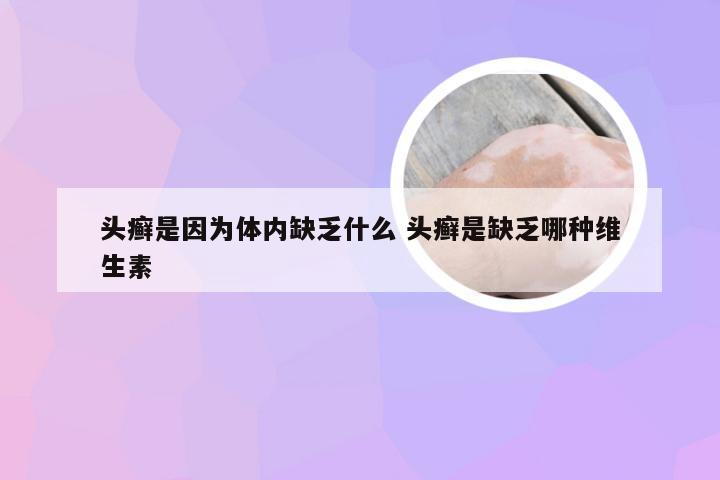 头癣是因为体内缺乏什么 头癣是缺乏哪种维生素