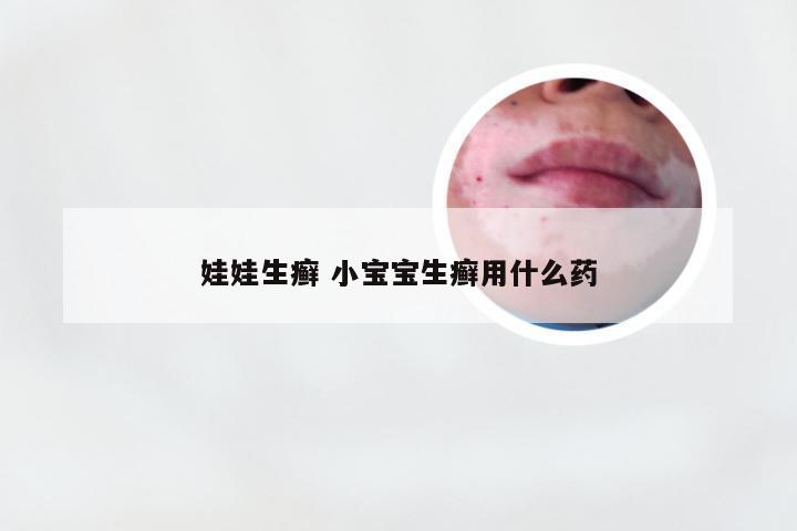 娃娃生癣 小宝宝生癣用什么药