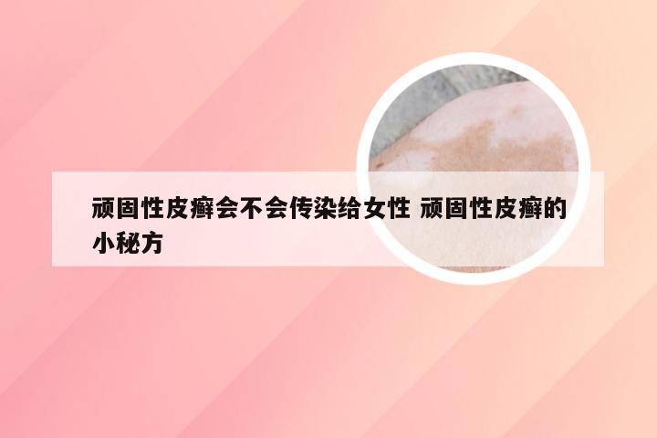 顽固性皮癣会不会传染给女性 顽固性皮癣的小秘方