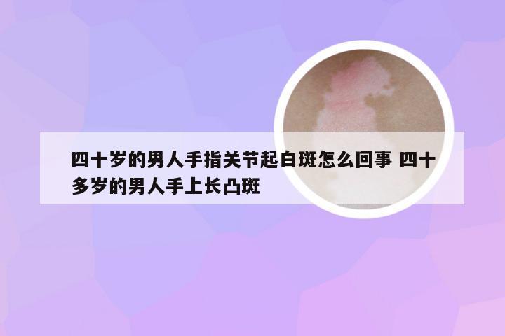 四十岁的男人手指关节起白斑怎么回事 四十多岁的男人手上长凸斑