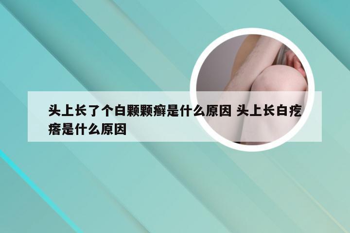 头上长了个白颗颗癣是什么原因 头上长白疙瘩是什么原因