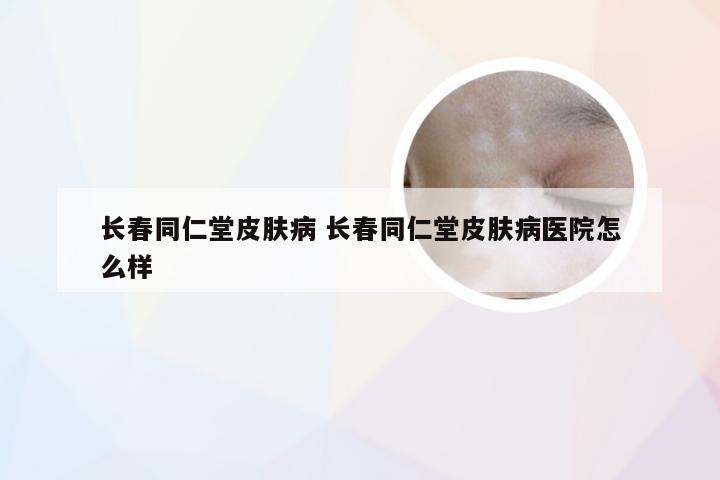 长春同仁堂皮肤病 长春同仁堂皮肤病医院怎么样