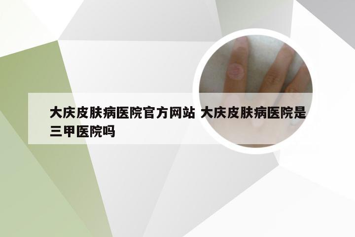 大庆皮肤病医院官方网站 大庆皮肤病医院是三甲医院吗