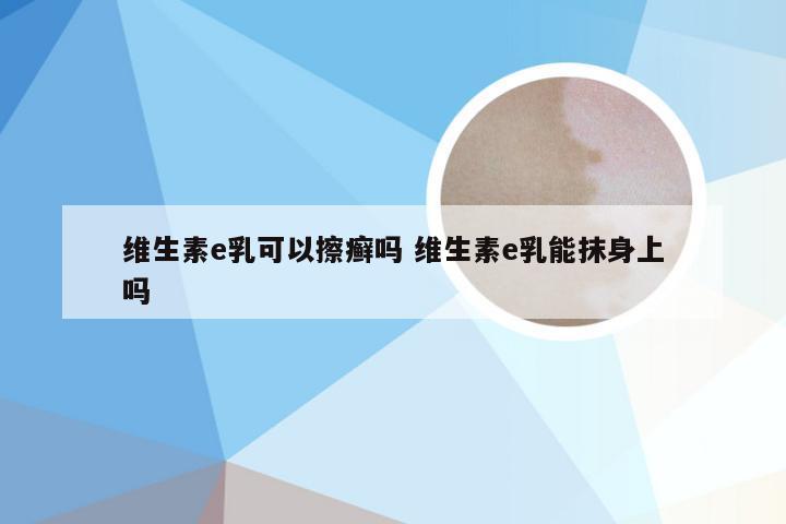 维生素e乳可以擦癣吗 维生素e乳能抹身上吗