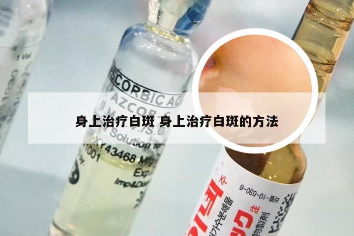 身上治疗白斑 身上治疗白斑的方法