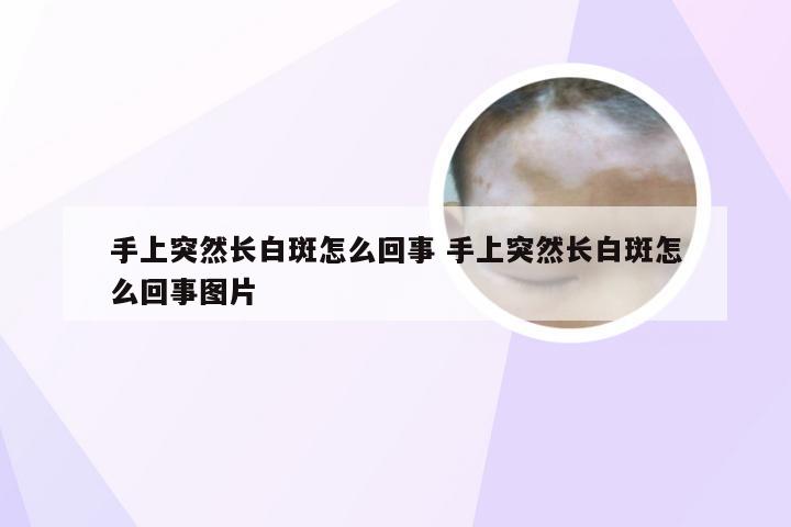 手上突然长白斑怎么回事 手上突然长白斑怎么回事图片