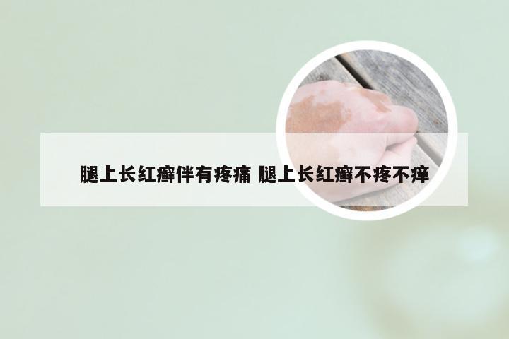 腿上长红癣伴有疼痛 腿上长红癣不疼不痒