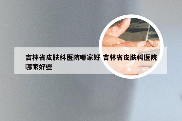 吉林省皮肤科医院哪家好 吉林省皮肤科医院哪家好些