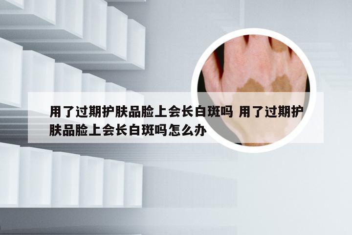 用了过期护肤品脸上会长白斑吗 用了过期护肤品脸上会长白斑吗怎么办