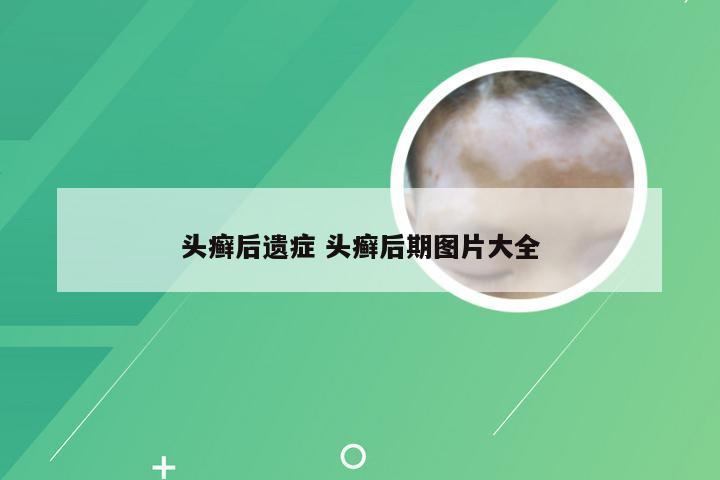 头癣后遗症 头癣后期图片大全