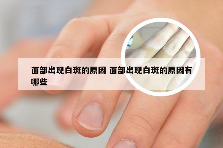 面部出现白斑的原因 面部出现白斑的原因有哪些