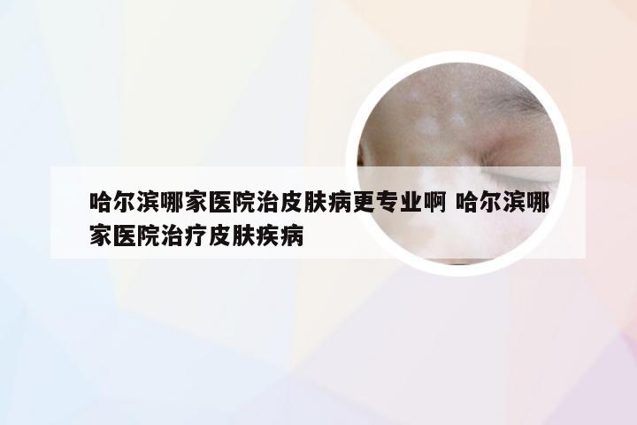 哈尔滨哪家医院治皮肤病更专业啊 哈尔滨哪家医院治疗皮肤疾病