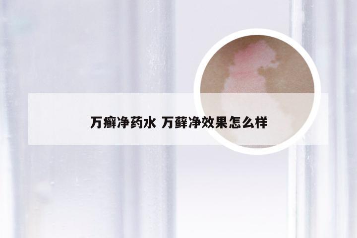 万癣净药水 万藓净效果怎么样