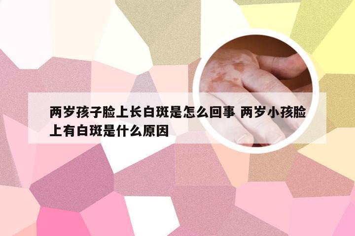 两岁孩子脸上长白斑是怎么回事 两岁小孩脸上有白斑是什么原因