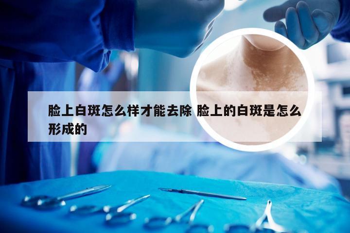 脸上白斑怎么样才能去除 脸上的白斑是怎么形成的