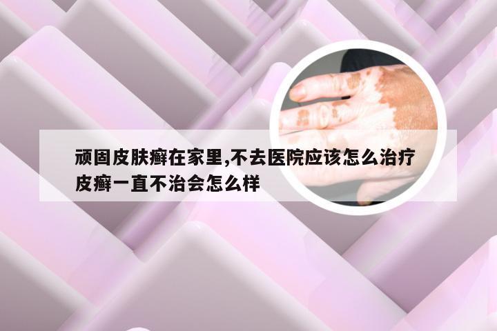 顽固皮肤癣在家里,不去医院应该怎么治疗 皮癣一直不治会怎么样