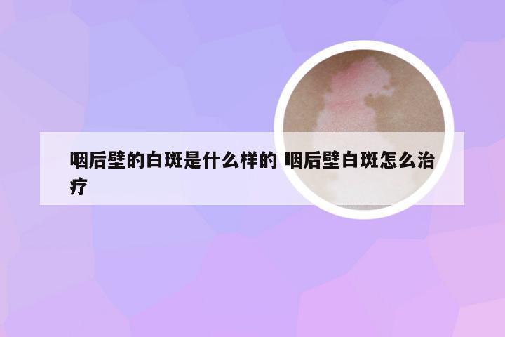 咽后壁的白斑是什么样的 咽后壁白斑怎么治疗