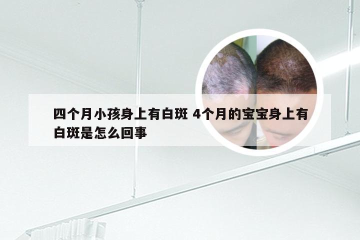 四个月小孩身上有白斑 4个月的宝宝身上有白斑是怎么回事