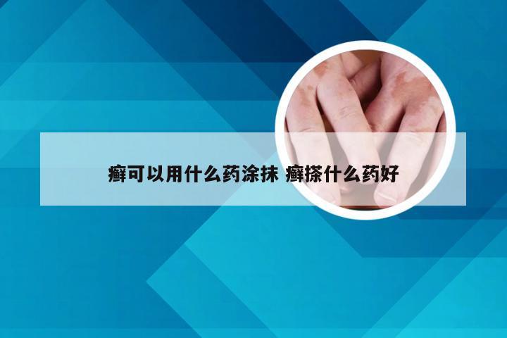 癣可以用什么药涂抹 癣搽什么药好