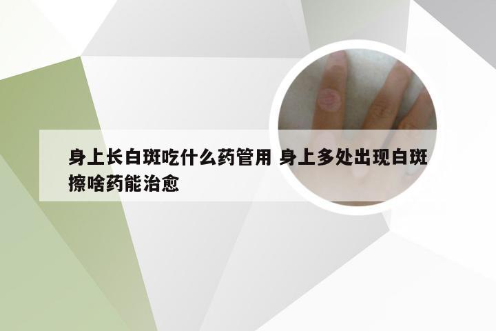 身上长白斑吃什么药管用 身上多处出现白斑擦啥药能治愈