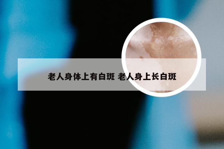 老人身体上有白斑 老人身上长白斑