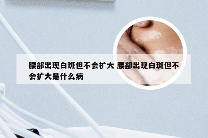 腰部出现白斑但不会扩大 腰部出现白斑但不会扩大是什么病