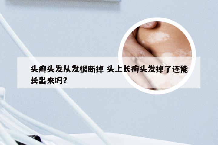 头癣头发从发根断掉 头上长癣头发掉了还能长出来吗?