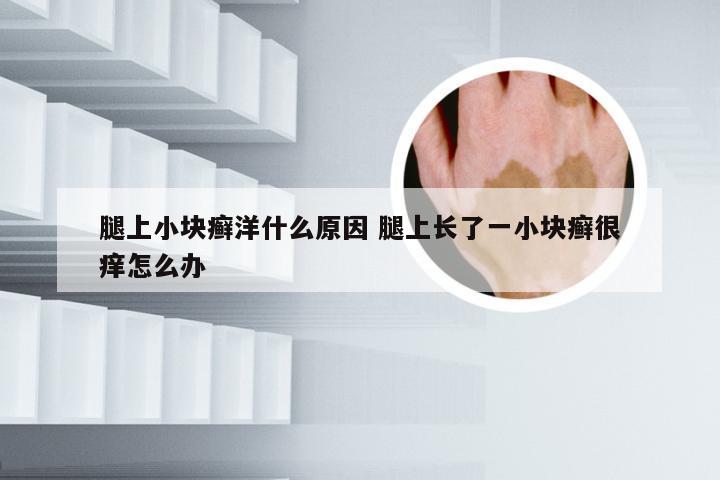 腿上小块癣洋什么原因 腿上长了一小块癣很痒怎么办