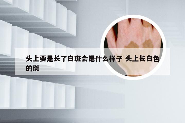 头上要是长了白斑会是什么样子 头上长白色的斑