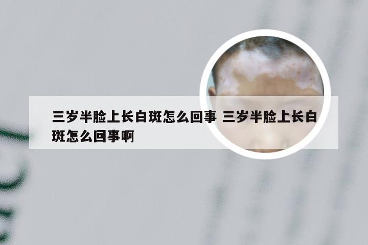 三岁半脸上长白斑怎么回事 三岁半脸上长白斑怎么回事啊