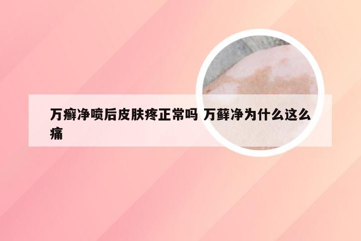 万癣净喷后皮肤疼正常吗 万藓净为什么这么痛